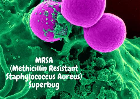 Mrsa Methicillin Resistant Staphylococcus Aureus What You Need To