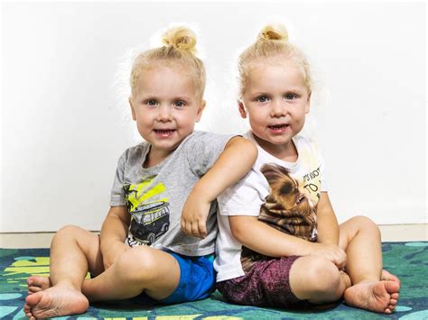 Twins Study Reveals Identical Twins Not As Similar As First Thought