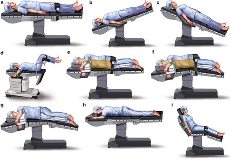 Patient Positioning And Common Nerve Injuries Springerlink