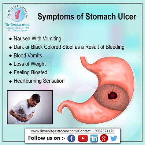 Stomach Cancer Stool