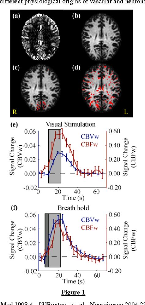 Figure 1 From Cerebral Blood Flow Cbf And Cerebral Blood Volume