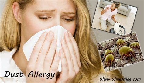Dust Allergy Causes Symptoms And Treatment
