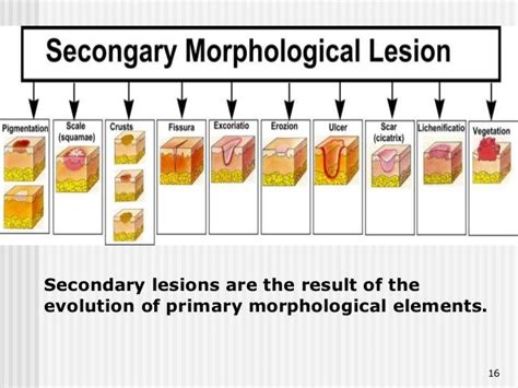 Primary Vs Secondary Skin Lesions