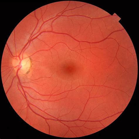 Diagnostics Retina Specialists Huntington Beach 92647