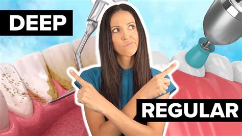 Deep Cleaning Vs Regular Cleaning Dental Hygienist Explains Youtube