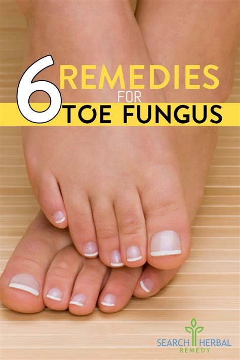 6 Natural Cure For Toe Fungus How To Cure Toe Fungus Naturally