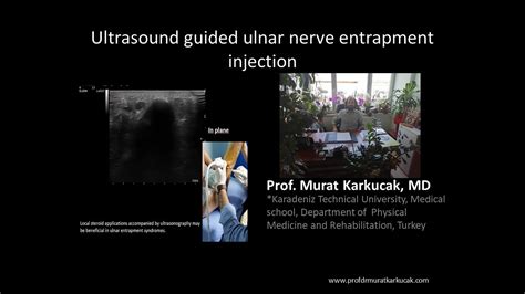 Ultrasound Guided Ulnar Nerve Entrapment Injection By Prof Murat