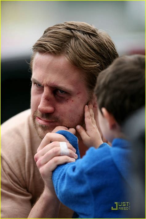 Ryan Gosling Gets A Black Eye Photo 1906841 Ryan Gosling Pictures Just Jared