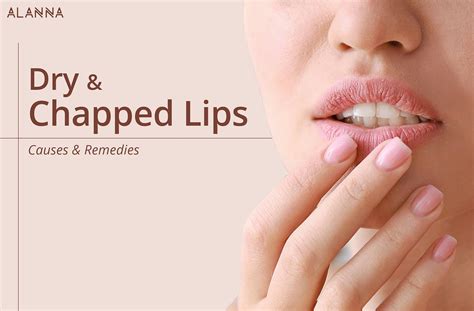 Dry And Chapped Lips Causes And Remedies Alanna Indias First