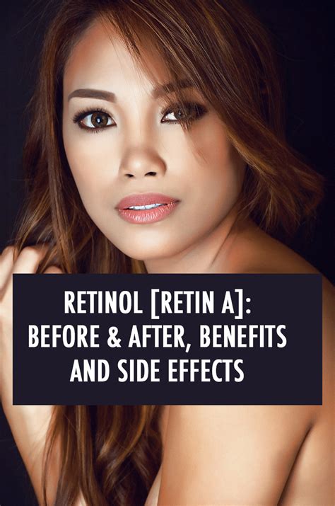 Retin A Before And After The Benefits And The Side Effects