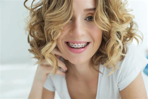 Dental Braces And Retainers Types Care What To Expect Camilo Riaño