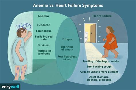 Anemia And Heart Failure Association And Treatment