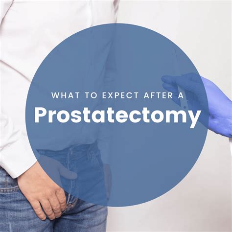 What To Expect After A Prostatectomy New York City Prostate Center