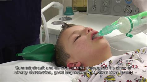 Paediatric Anaesthetics Chapter 2 Lma Insertion 1 Youtube