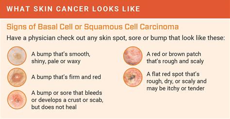 What Does Skin Cancer Look Like At First