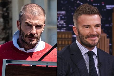 Update More Than 170 David Beckham Hair Transformation Best Dedaotaonec