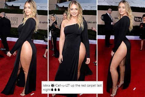 Iskra Lawrence Proudly Shows Cellulite In Daring Thigh Split Gown