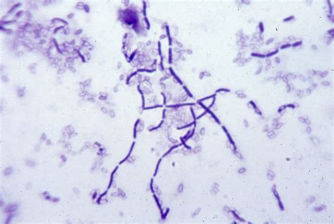 Bacillus Subtilis Spore Stain