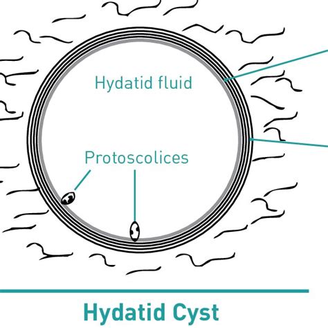 Structure Of The Hydatid Cyst Download Scientific Diagram