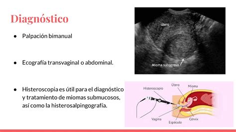 Tumores Benignos Y Malignos De Utero Miomas Hiperplasia Uterina Y