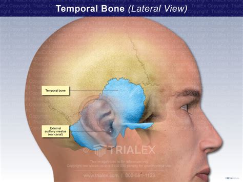 Temporal Bone Lateral View Trial Exhibits Inc