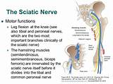 Photos of Sciatic Nerve Damage Treatment Options