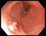 Images of Gastric Intestinal Doctor