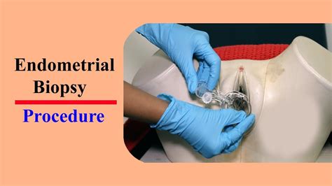 Endometrial Biopsy Procedure And Side Effects Of This Endometrial