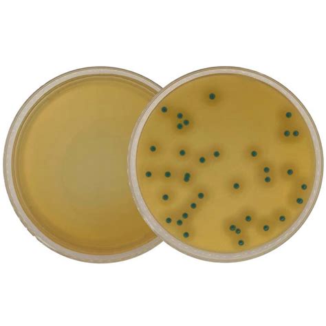 Ottaviani Agosti Listeria Agar Aloa Acc To Iso 11290 Generon