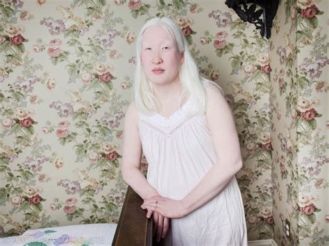 Albinism Photographs Popsugar Beauty Photo