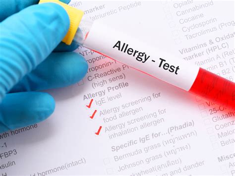 To obtain information on a specific test, click on the relevant animal blood films collect moisture if stored in the fridge. Blood testing for allergies