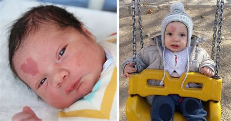 We did not find results for: People Are In Love With This Baby Born With A Heart-Shaped ...