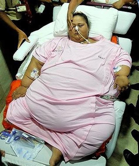 Worlds Fattest Woman Leaves Hospital After Shedding 52 Stone Daily