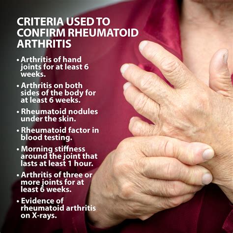 Rheumatoid Arthritis Of The Hand Florida Orthopaeidic