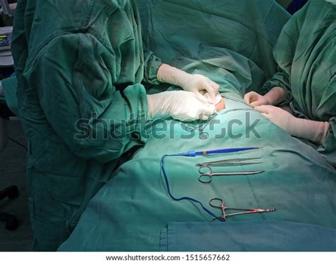 Removal Foreskin Under General Anaesthesia Circumcision Foto Stock 1515657662 Shutterstock