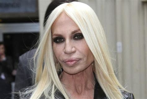 Donatella Versace After Plastic Surgery And Botox Celebrity Plastic