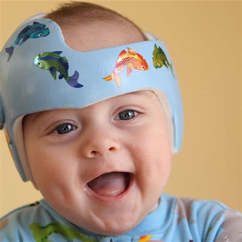 Baby Helmet Therapy Parent Faqs