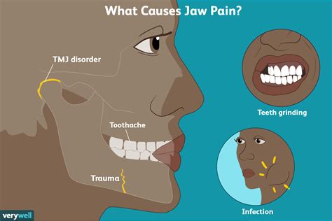 Jaw And Ear Pain On One Side Covid