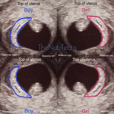 Weeks Pregnant Ultrasound Gender Video Bokep Ngentot