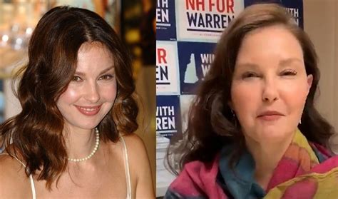Has Ashley Judd Had Plastic Surgery Face Before And After