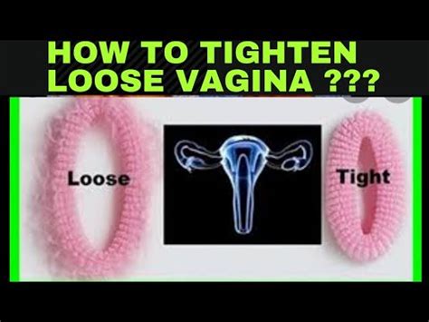 How To Tighten Loose Vagina After Delivery Vaginoplasty Dr Raman My