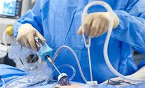 Laparoscopic Surgery Drmehtas Hospitals