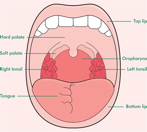 Oral Cavity Tongue And Mandibular Reconstructions Pla