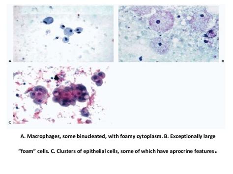 Cytology Of The Breast