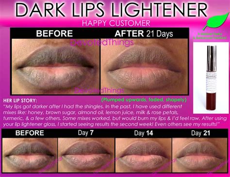 This Is The 5th Model For This Amazing Dark Lips Lightening Gloss See