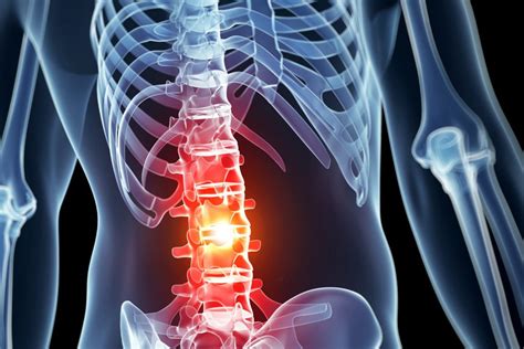 Spinal Cord Injury Eandl Law