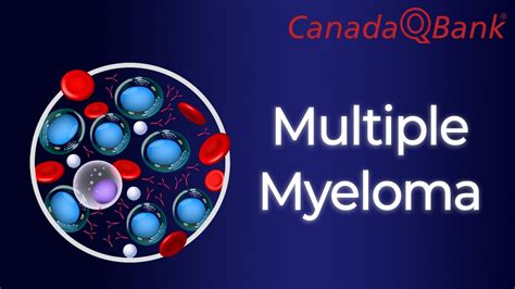 Multiple Myeloma Youtube