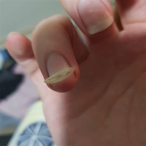 Bent My Fingernail All The Way Back Trying To Squash A Cockroach Never Have I Grabbed The Nail