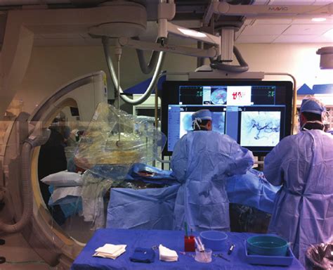 Configuration Of Angiography Suite During Tace The C Arm Is Aligned