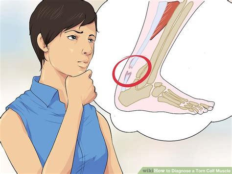 3 Ways To Diagnose A Torn Calf Muscle Wikihow